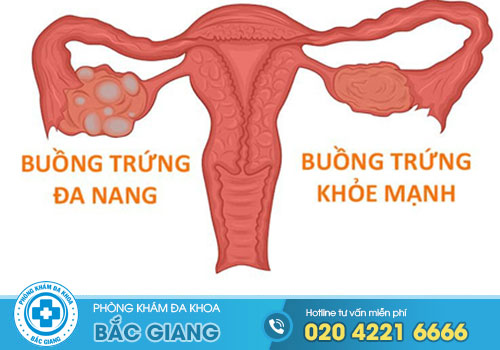 benh-da-nang-buong-trung